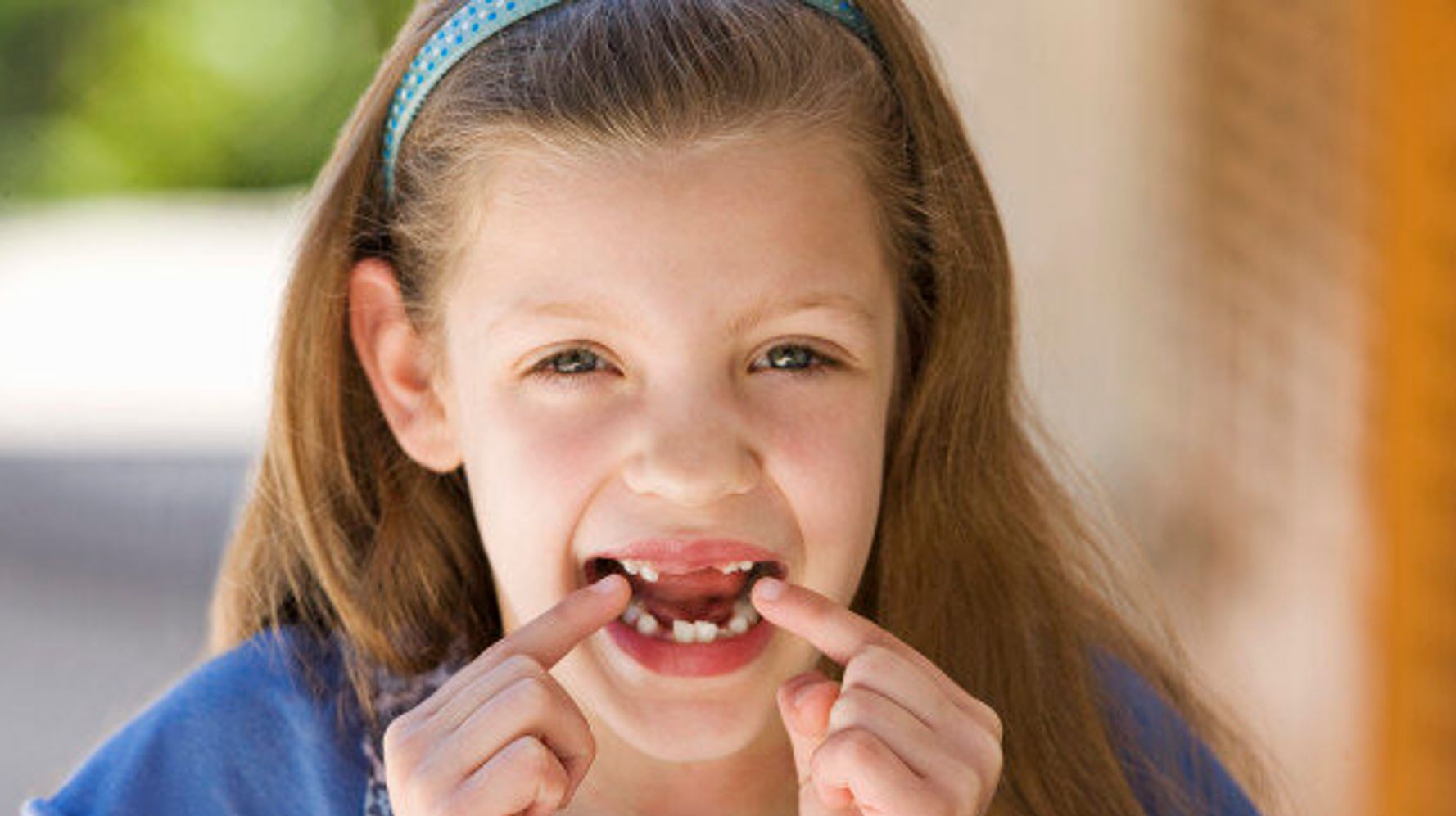 Missing Teeth Treatment