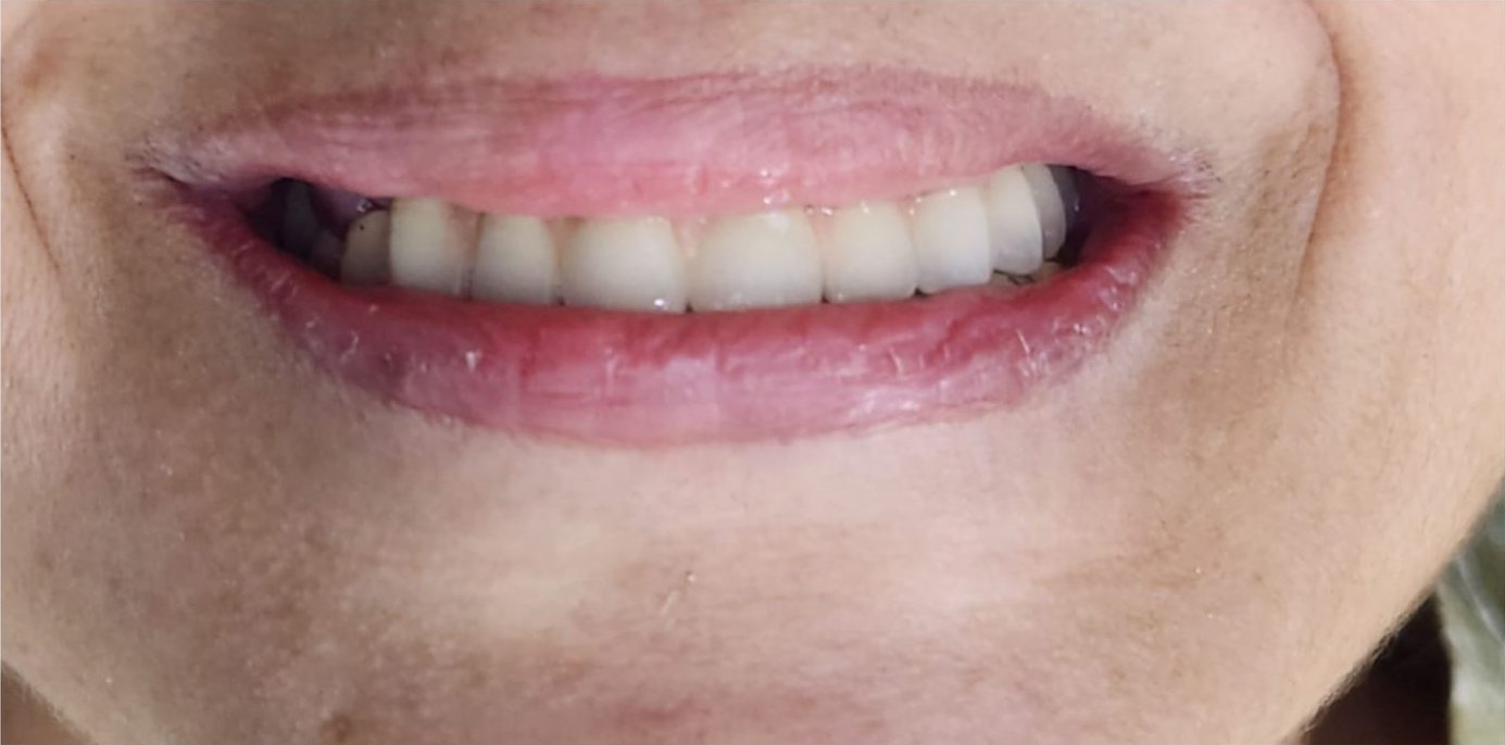 best dental clinic in lahore