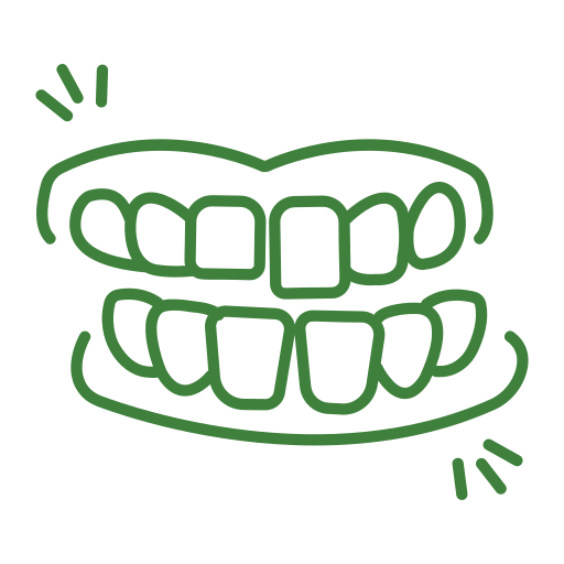 Clear Aligners