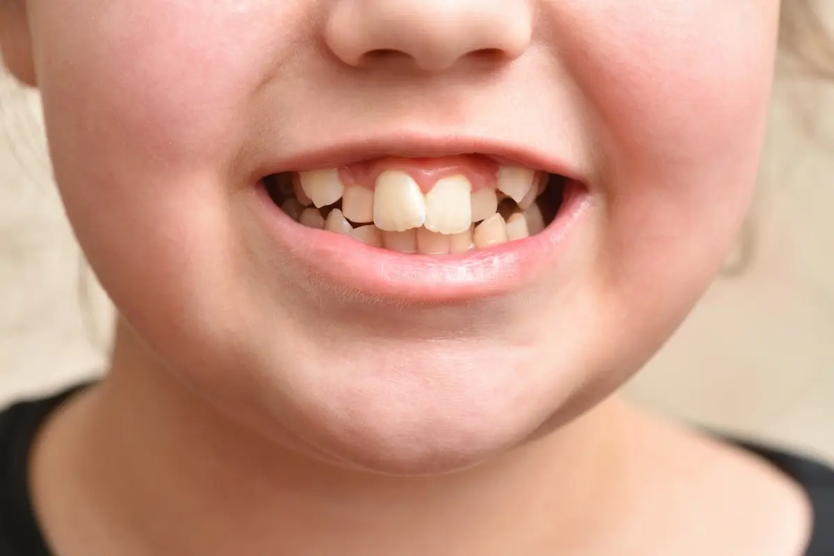 orthodontic treatment
