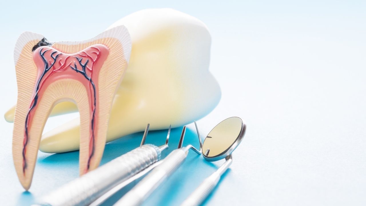 Professional Root Canal Treatment in Lahore