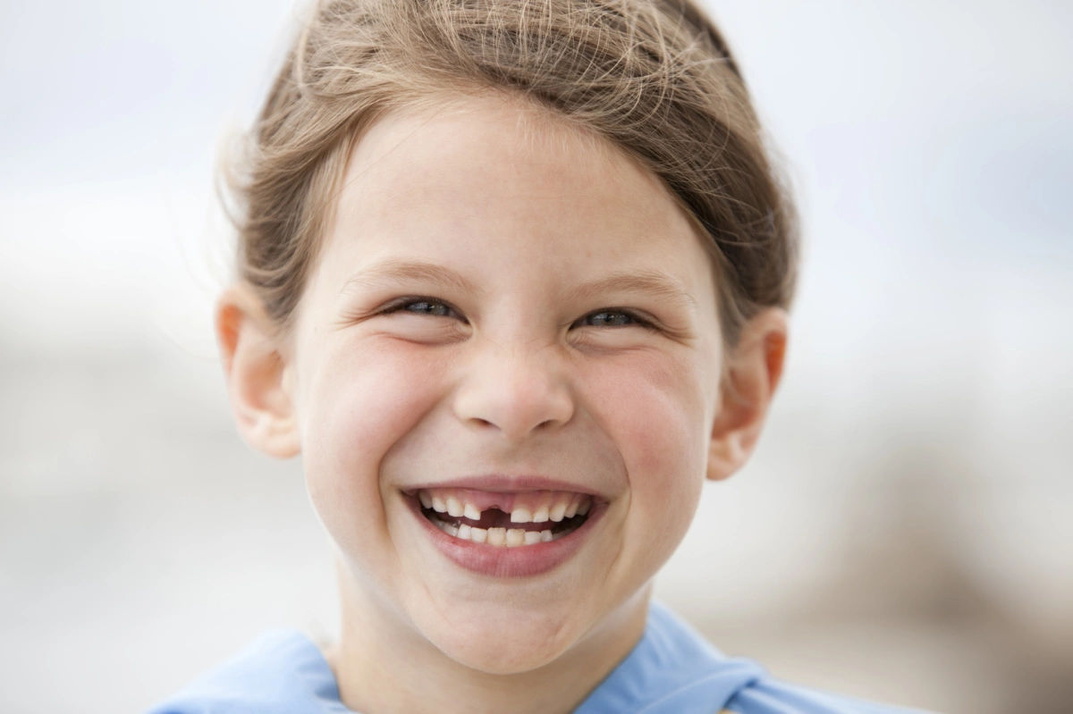 Missing Teeth Treatment