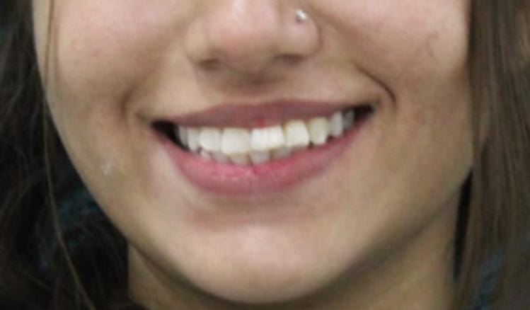 braces price in pakistan lahore